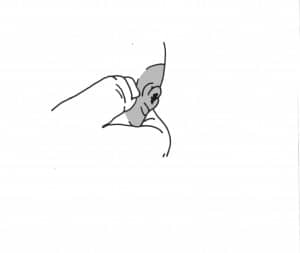 inverted nipple-edit