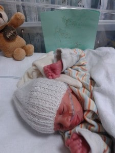 Premature baby in SCBU